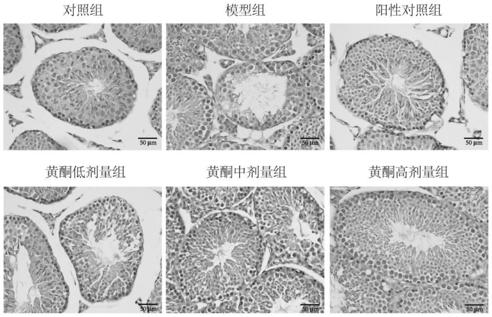 女貞子黃酮提取物在制備少弱精癥治療藥物中的應用